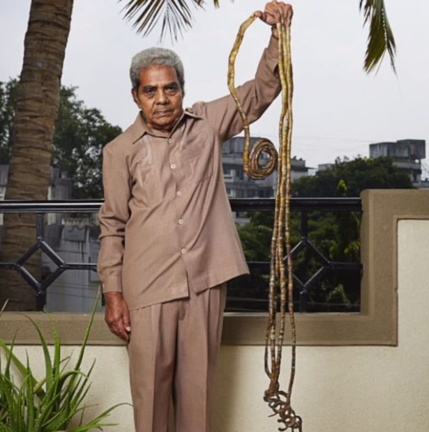 Шридхар Чиллал - индус с самыми длинными ногтями в мире