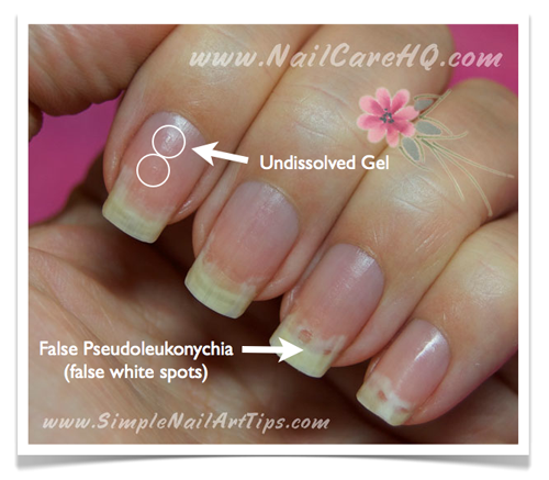Remove-Gel-Nails-White-Spots-in-Nails